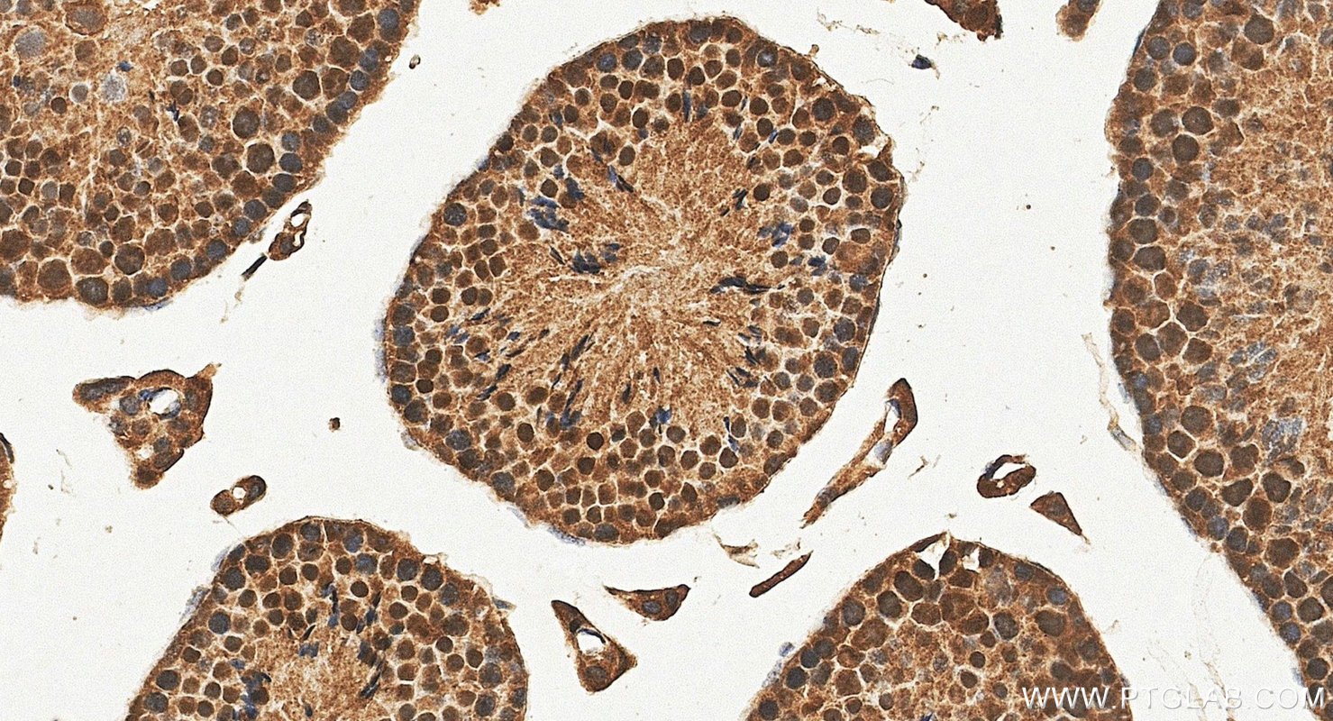IHC staining of mouse testis using 16859-1-AP IHC staining of mouse testis using 16859-1-AP
