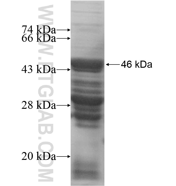 SYCP1 fusion protein Ag16724 SDS-PAGE SYCP1 fusion protein Ag16724 SDS-PAGE