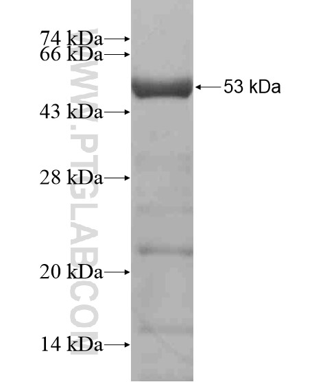 SYCP2 fusion protein Ag20076 SDS-PAGE SYCP2 fusion protein Ag20076 SDS-PAGE
