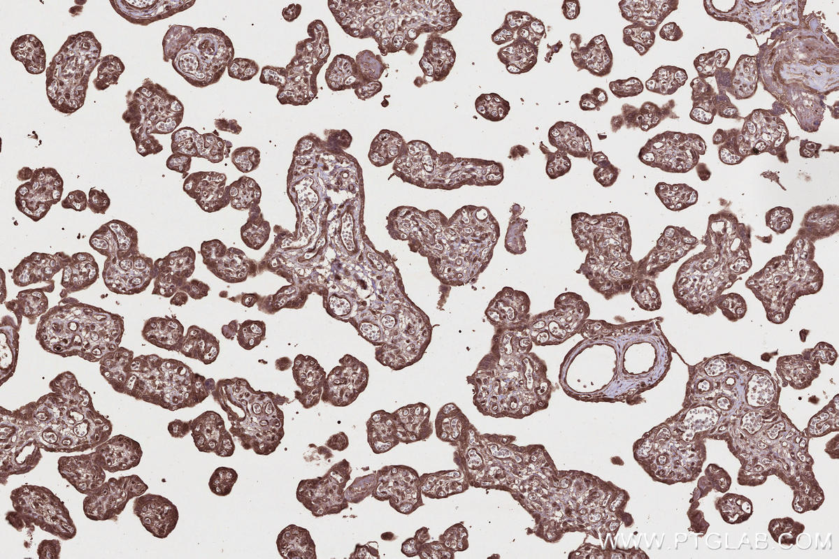 IHC staining of human placenta using 23024-1-AP