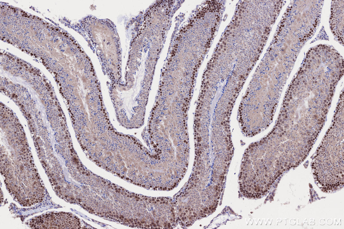 IHC staining of mouse testis using 30079-1-AP