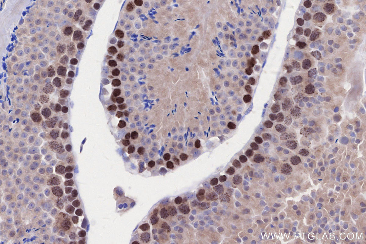 IHC staining of mouse testis using 30079-1-AP