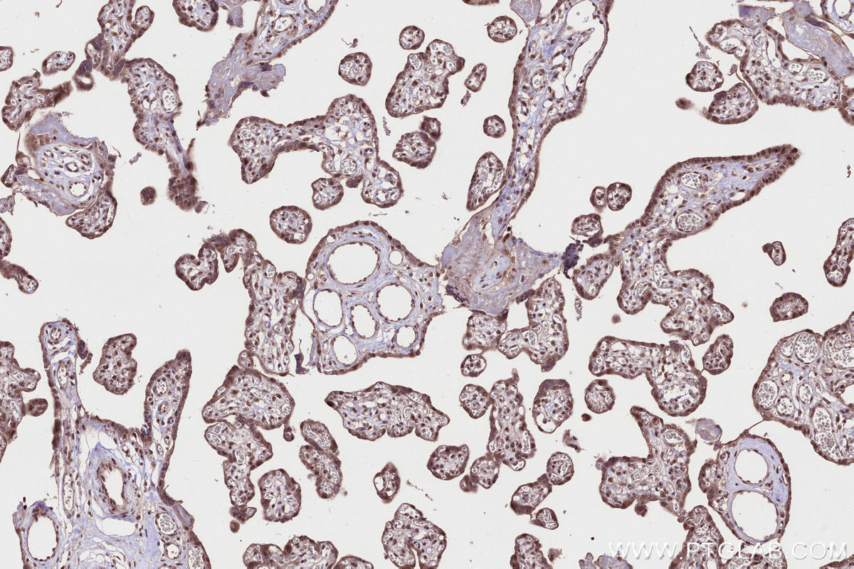 IHC staining of human placenta using 30079-1-AP