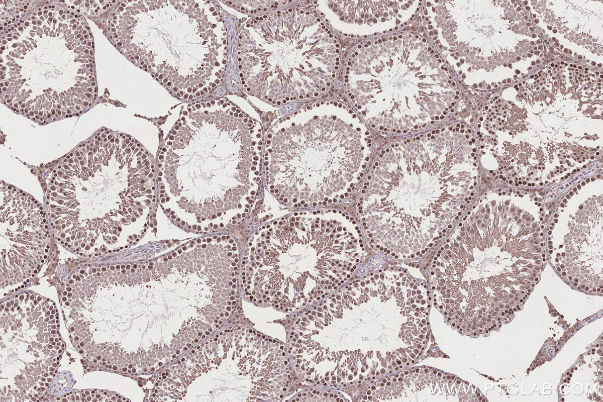 IHC staining of rat testis using 30079-1-AP