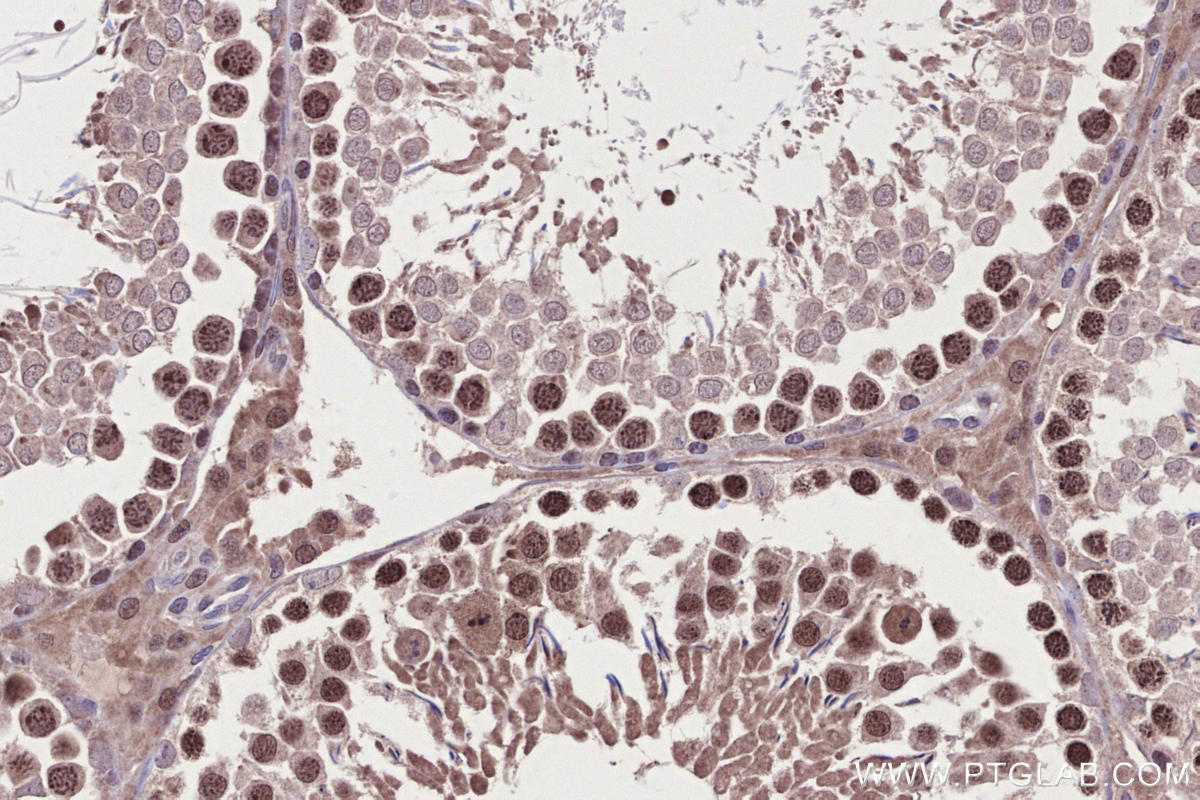 IHC staining of rat testis using 30079-1-AP