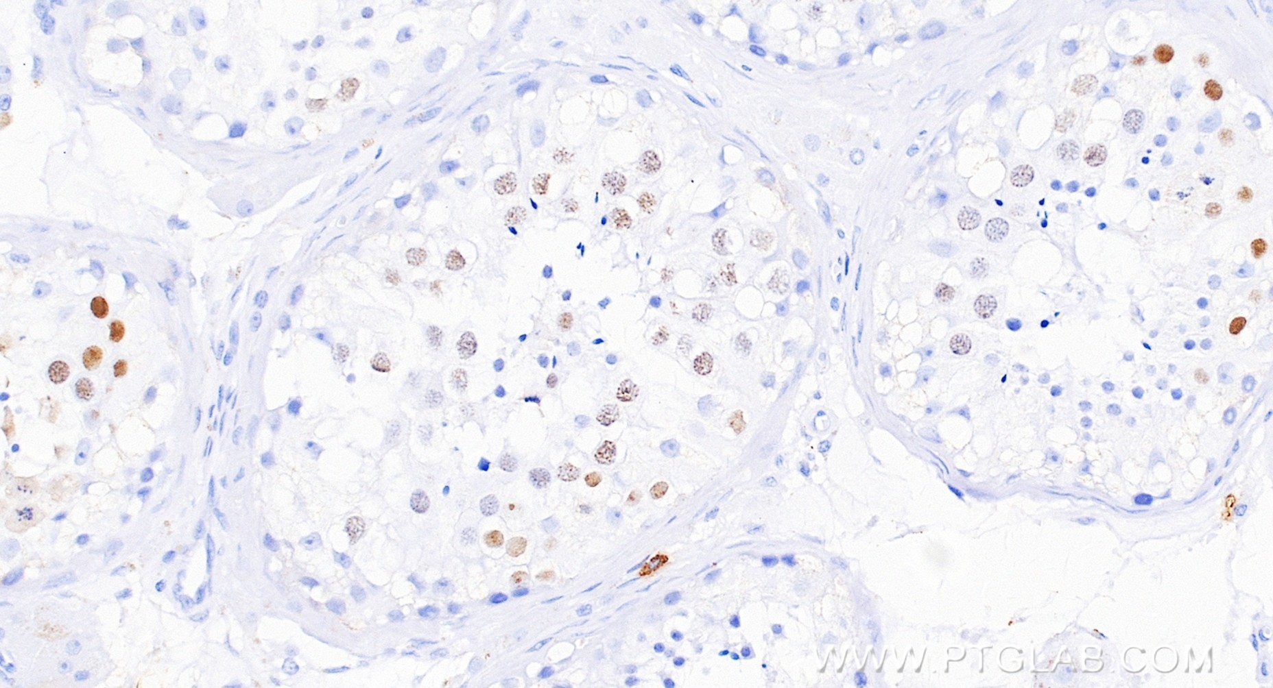IHC staining of human testis using 86648-2-RR IHC staining of human testis using 86648-2-RR
