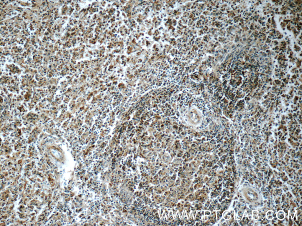 IHC staining of human spleen using 22206-1-AP