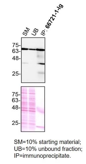 IP experiment of MDA-MB-231 using 66721-1-Ig (same clone as 66721-1-PBS)