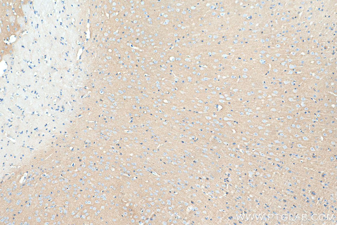 IHC staining of mouse brain using 20258-1-AP