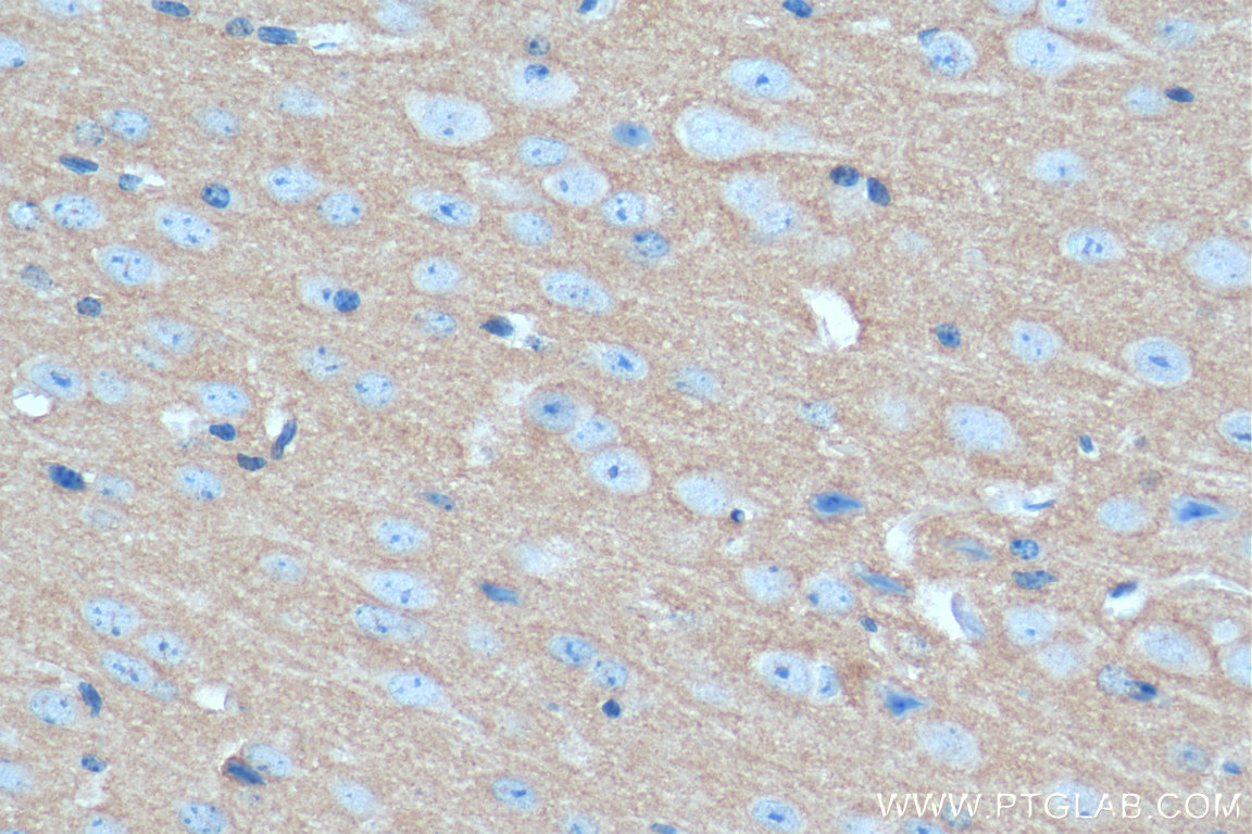 IHC staining of mouse brain using 20258-1-AP