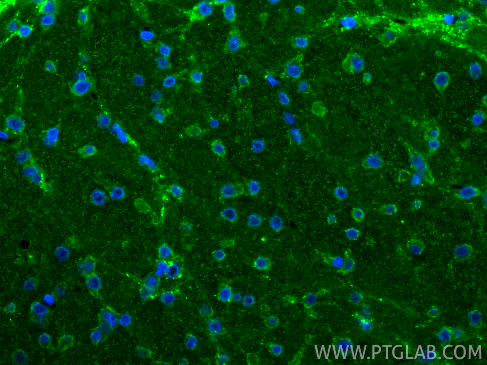 IF Staining of rat brain using 85360-1-RR