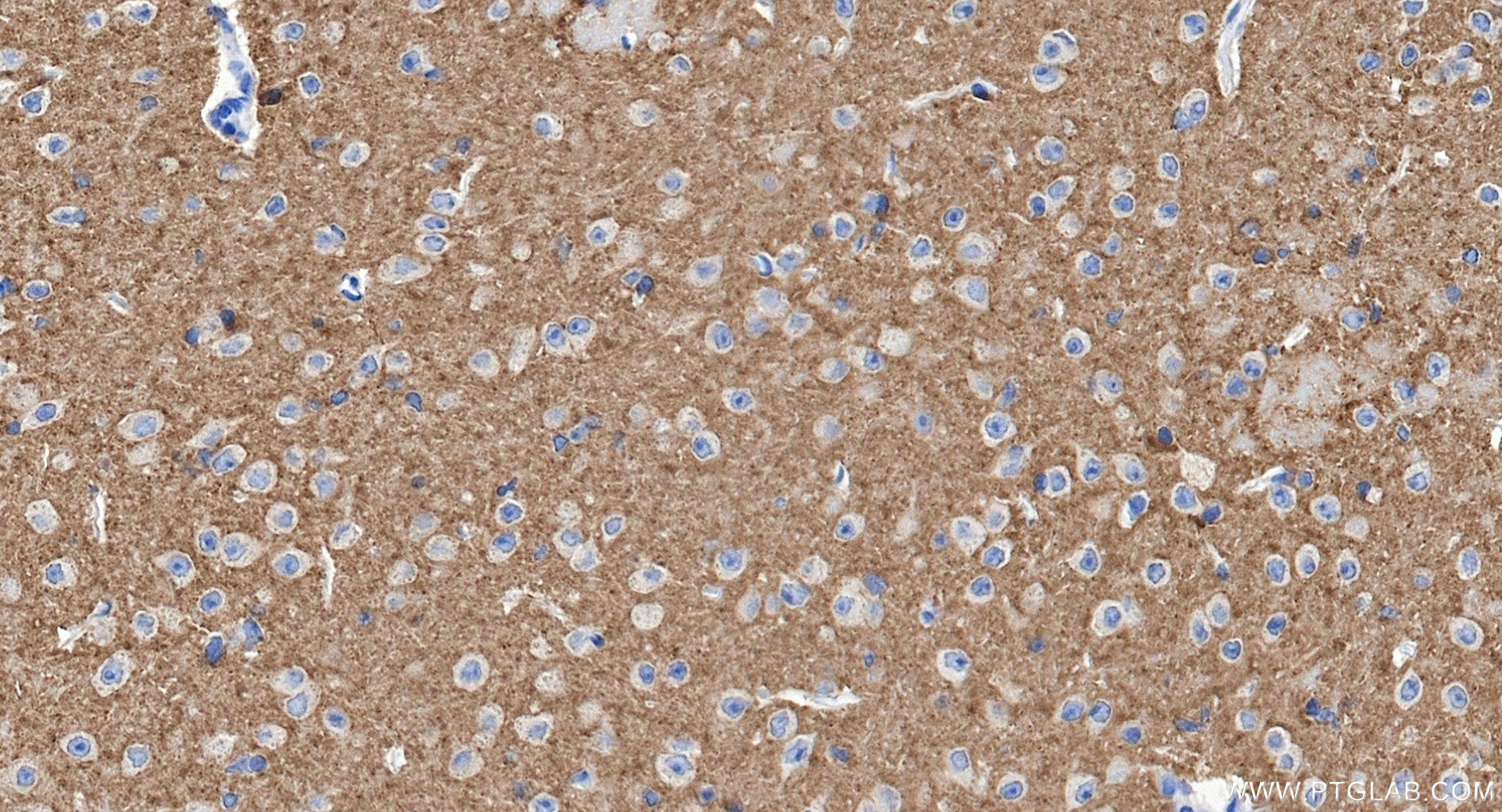 IHC staining of mouse brain using 85360-1-RR (same clone as 85360-1-PBS)