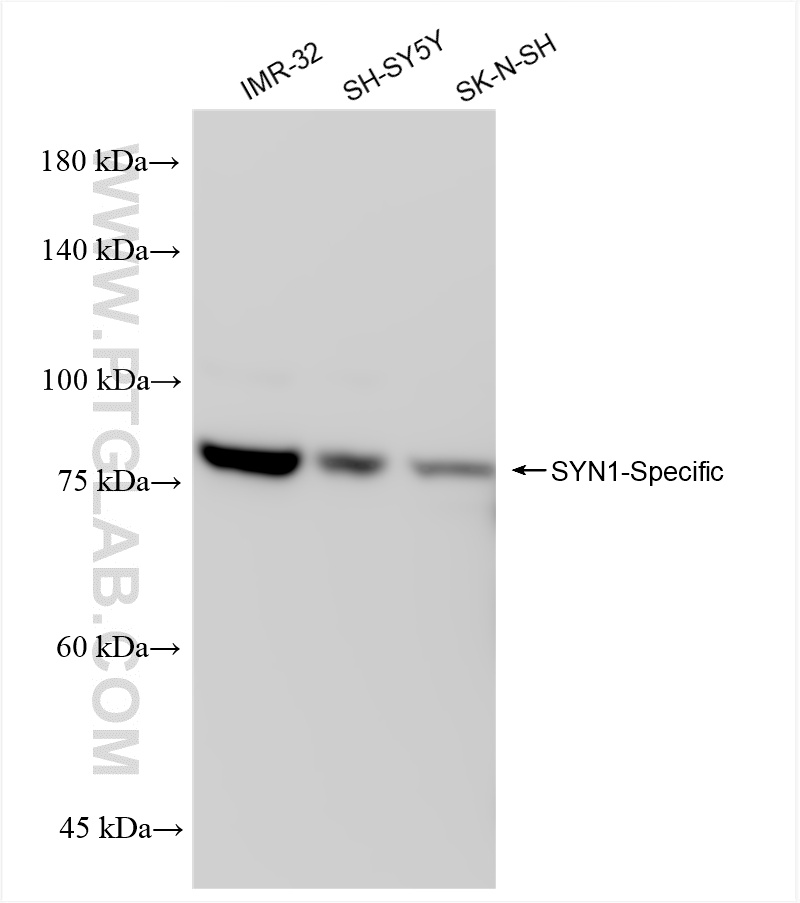 WB analysis using 85360-1-RR (same clone as 85360-1-PBS)