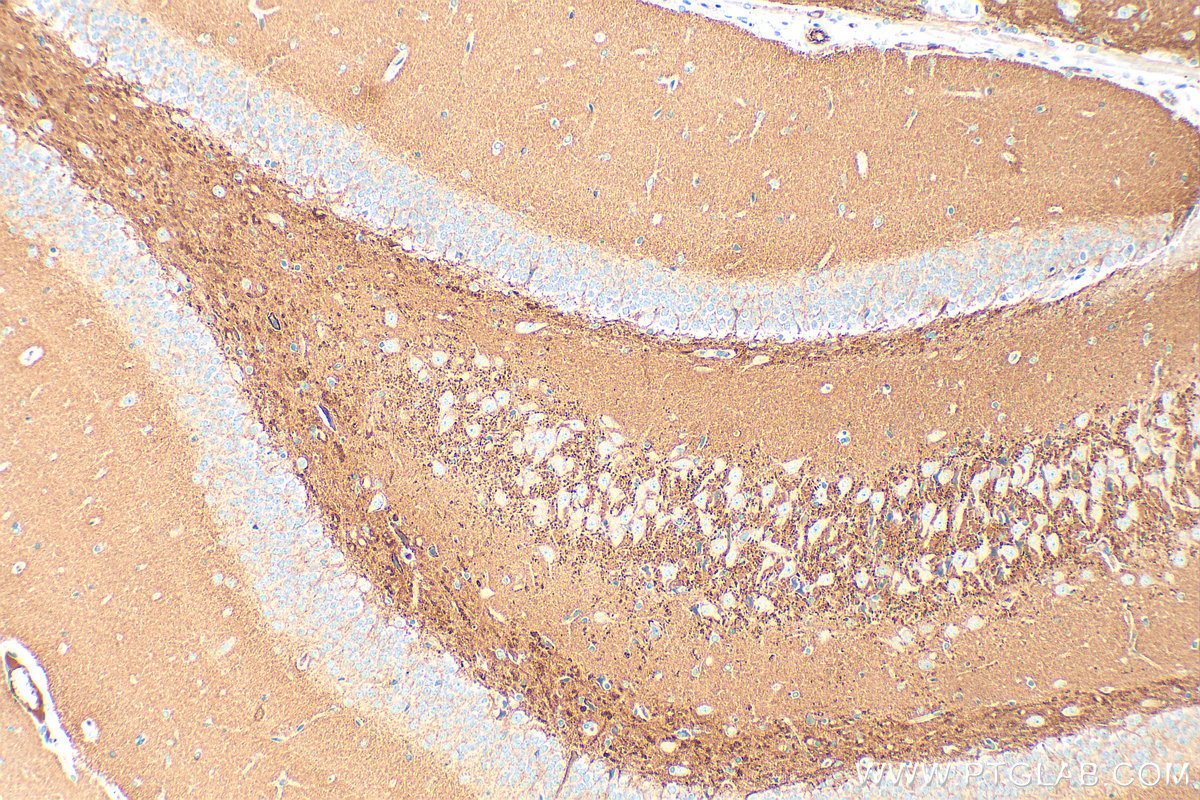 Immunohistochemical analysis of paraffin-embedded rat brain tissue slide using 16573-1-AP (SYN2 antibody) at dilution of 1:600 (under 10x lens). Heat mediated antigen retrieval with Tris-EDTA buffer (pH 9.0). IHC staining of rat brain using 16573-1-AP