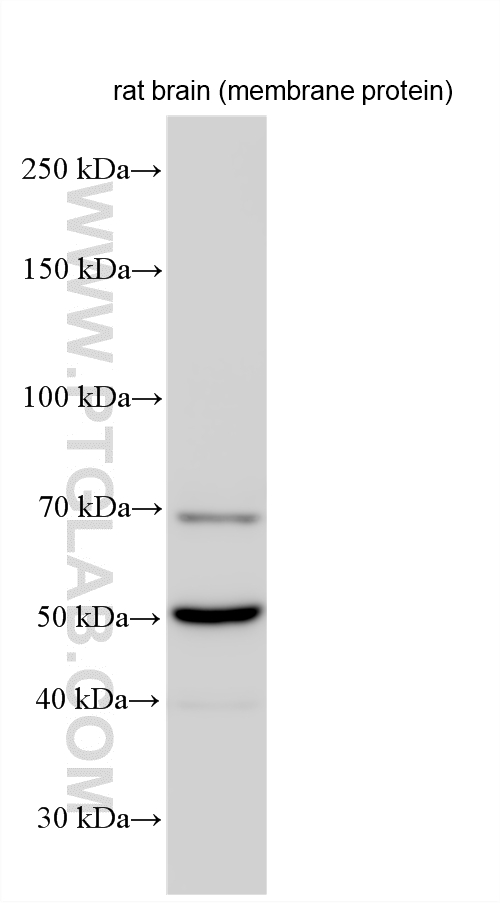 Rat brain membrane protein was subjected to SDS PAGE followed by western blot with 16573-1-AP (SYN2 antibody) at dilution of 1:20000 incubated at room temperature for 1.5 hours. WB analysis using 16573-1-AP
