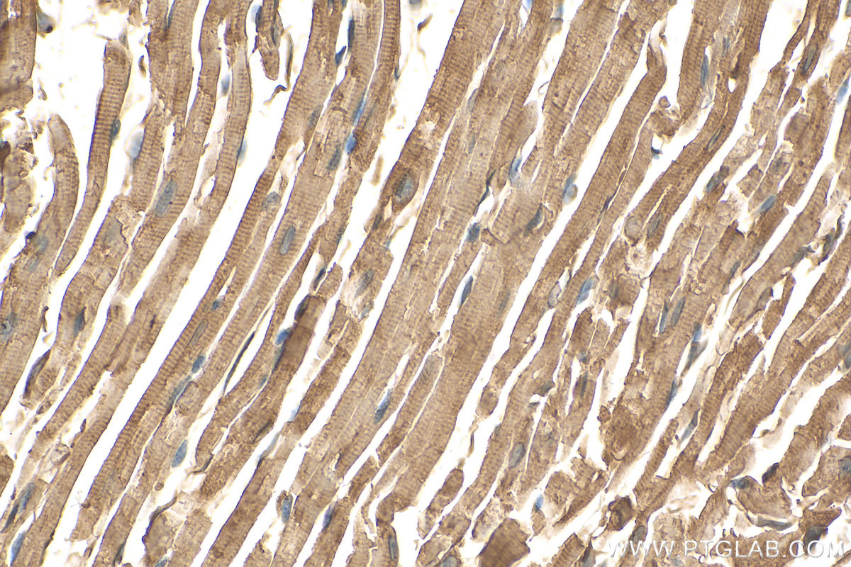 IHC staining of mouse heart using 25151-1-AP