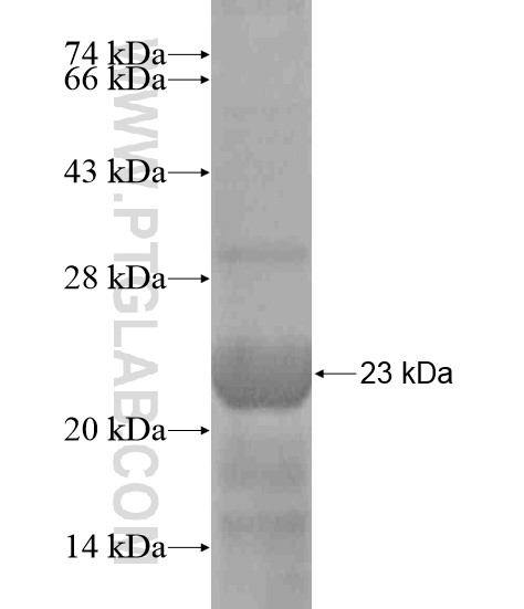 SYNC fusion protein Ag18664 SDS-PAGE SYNC fusion protein Ag18664 SDS-PAGE