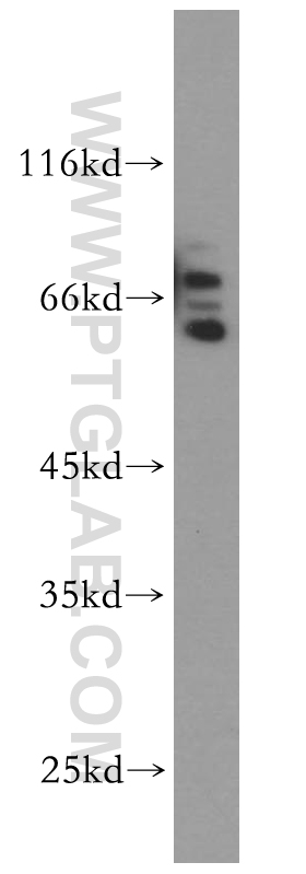 WB analysis of A431 using 14024-1-AP