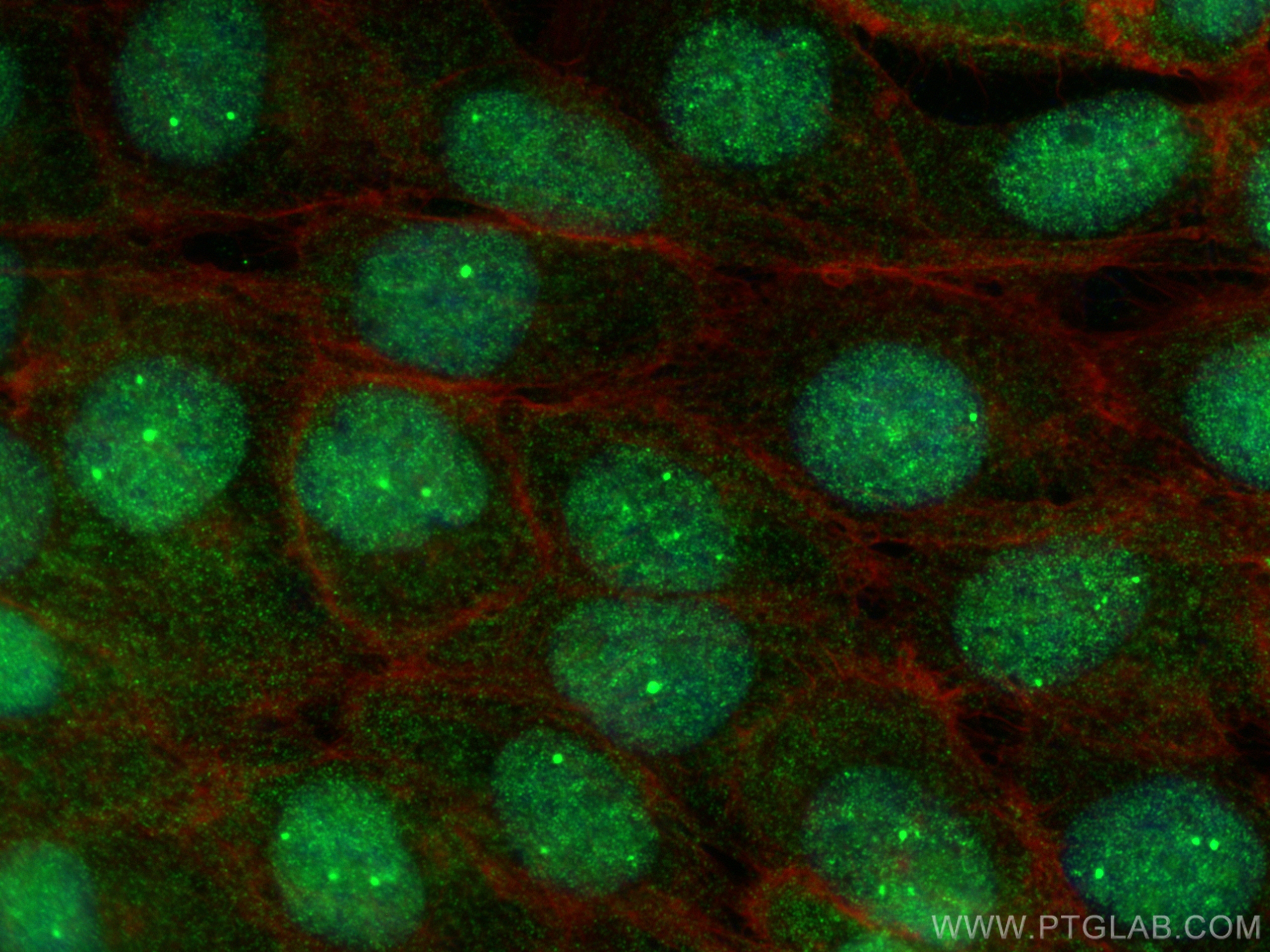 IF Staining of A431 using 30443-1-AP