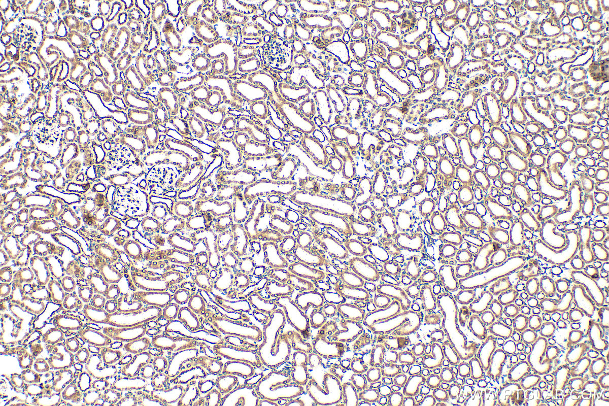 IHC staining of mouse kidney using 30443-1-AP IHC staining of mouse kidney using 30443-1-AP