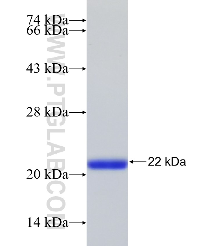 SYNCRIP fusion protein Ag31549 SDS-PAGE