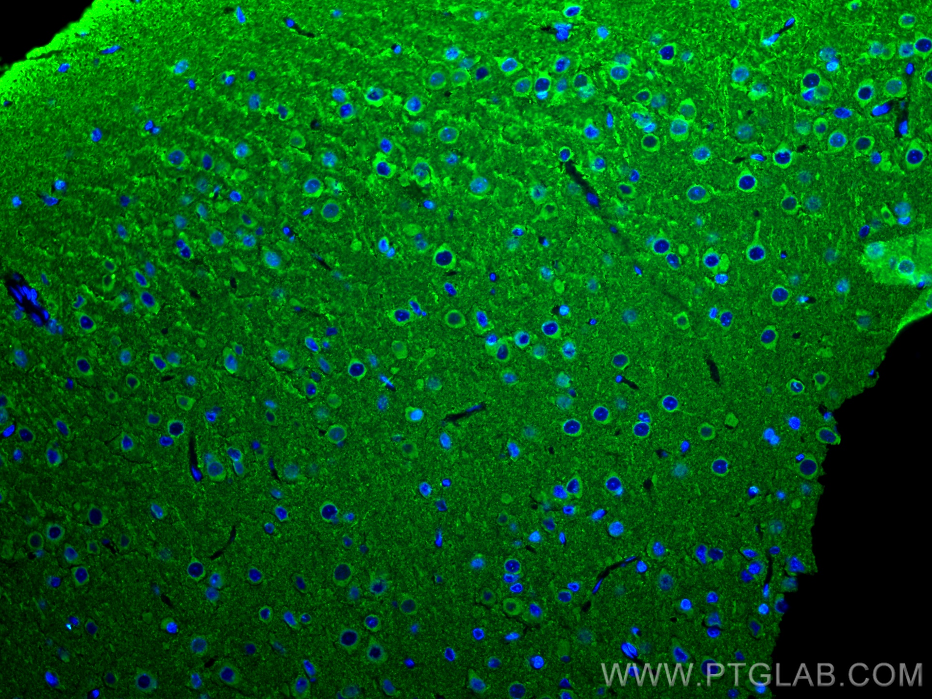 IF Staining of rat brain using 25265-1-AP