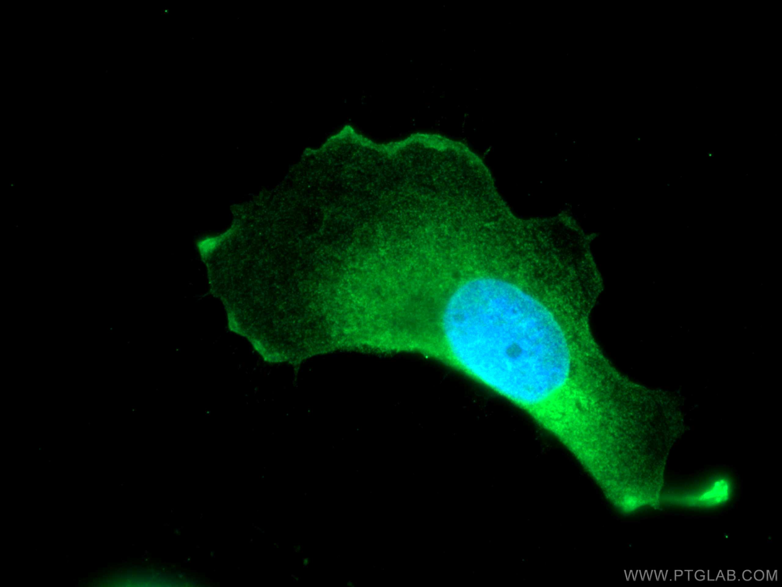 IF Staining of U-251 using 19739-1-AP