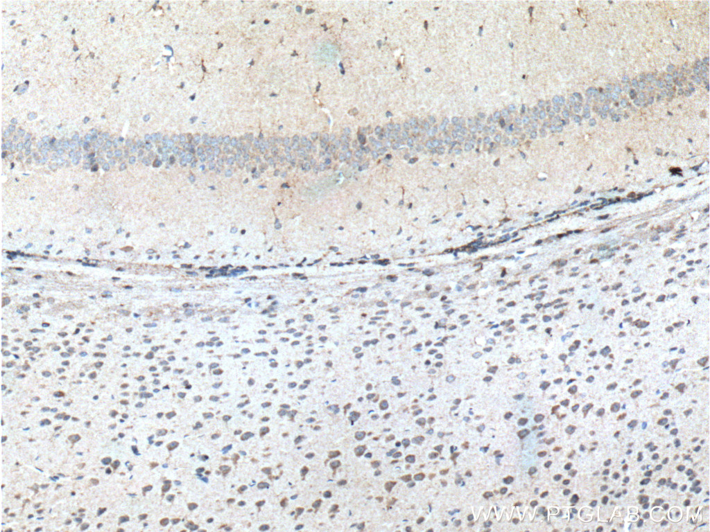 IHC staining of mouse brain using 19739-1-AP
