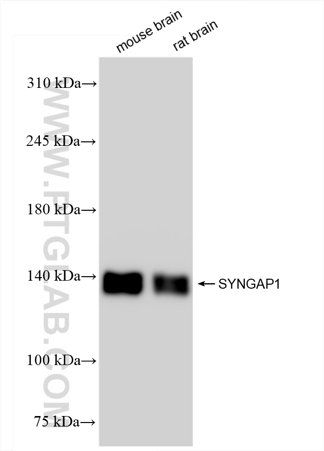 WB analysis using 85045-1-RR (same clone as 85045-1-PBS)