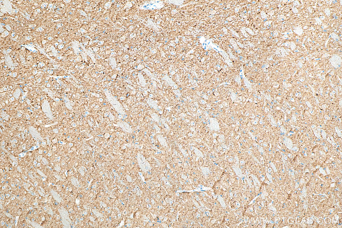 IHC staining of rat brain using 68176-1-Ig