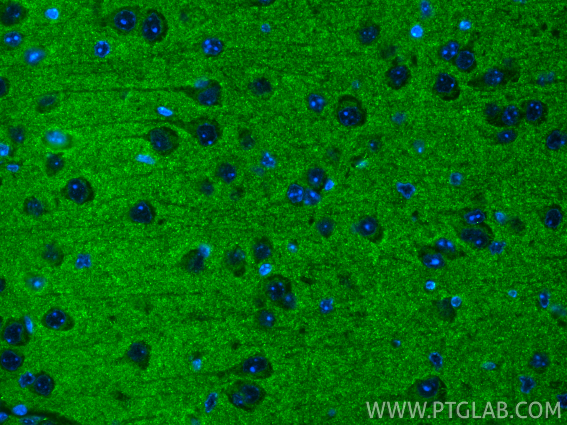IF Staining of mouse brain using CL488-84161-3