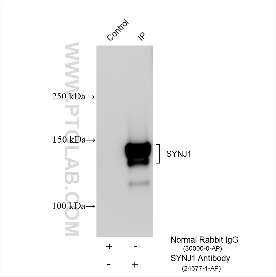 IP result of anti-SYNJ1 (IP:24677-1-AP, 4ug; Detection:24677-1-AP 1:5000) with mouse brain tissue lysate 1960 ug. IP experiment of mouse brain using 24677-1-AP