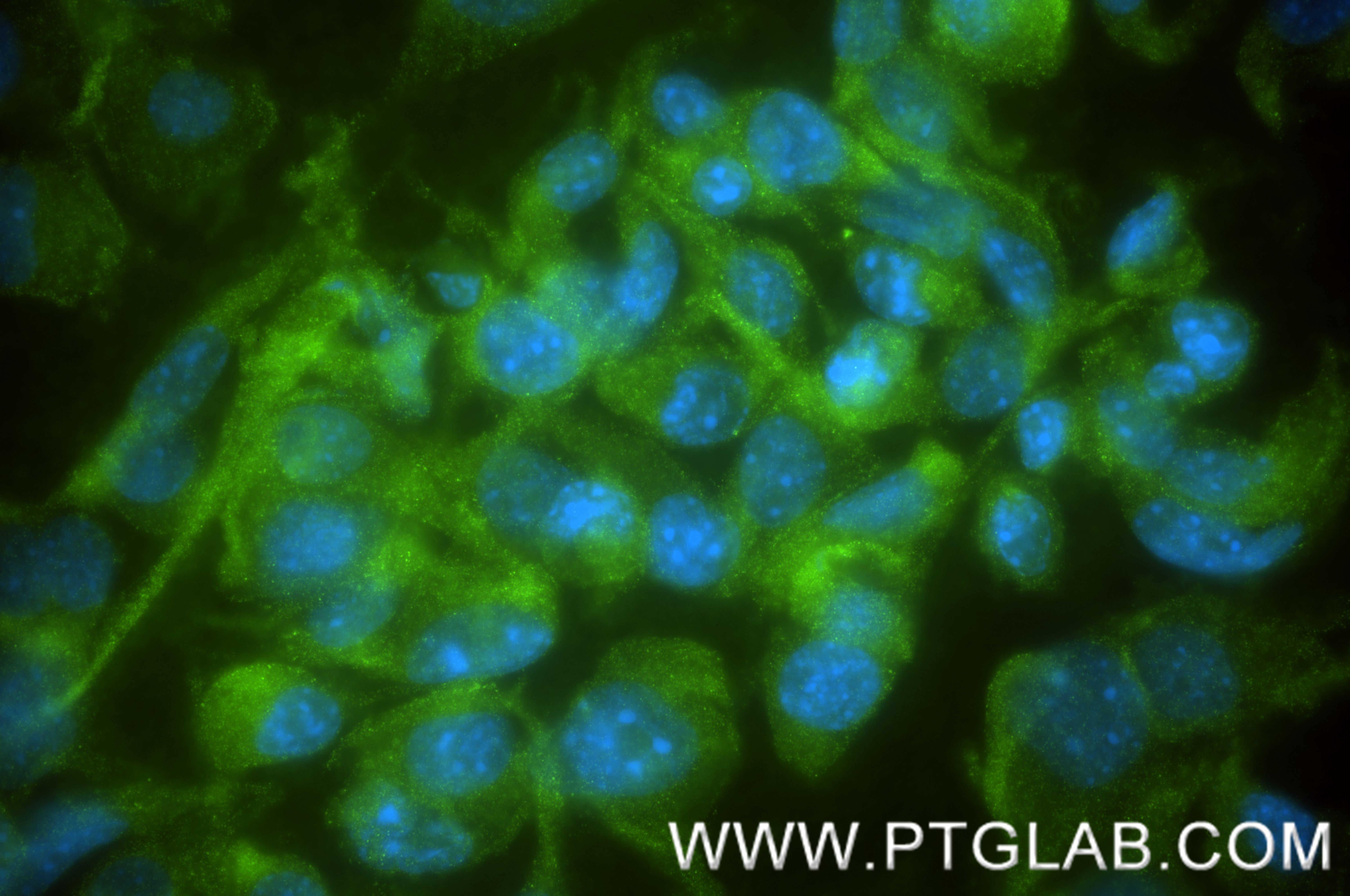 IF Staining of NIH/3T3 using 87620-1-RR (same clone as 87620-1-PBS)