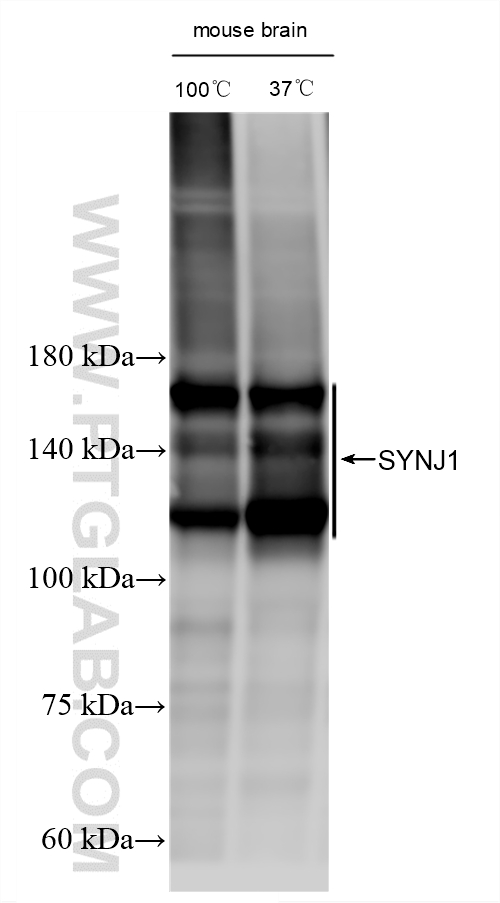 WB analysis using 87620-3-RR WB analysis using 87620-3-RR