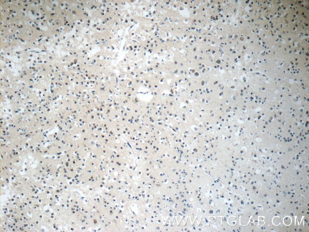 IHC staining of human brain using 13893-1-AP