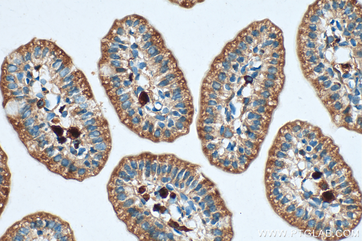 IHC staining of mouse small intestine using 30391-1-AP