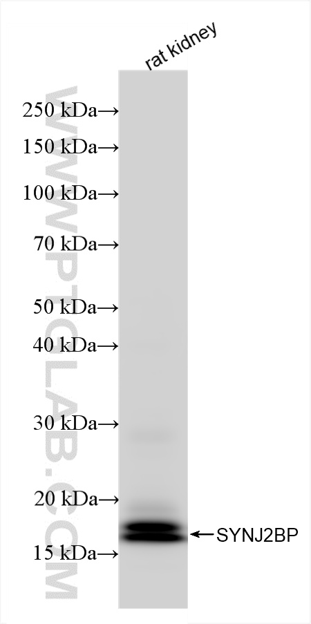 WB analysis of rat kidney using 85870-4-RR (same clone as 85870-4-PBS)