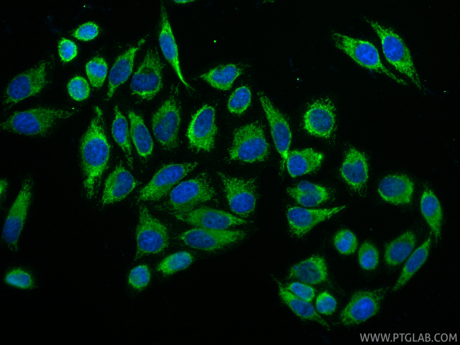 IF Staining of HepG2 using RMX00068 IF Staining of HepG2 using RMX00068