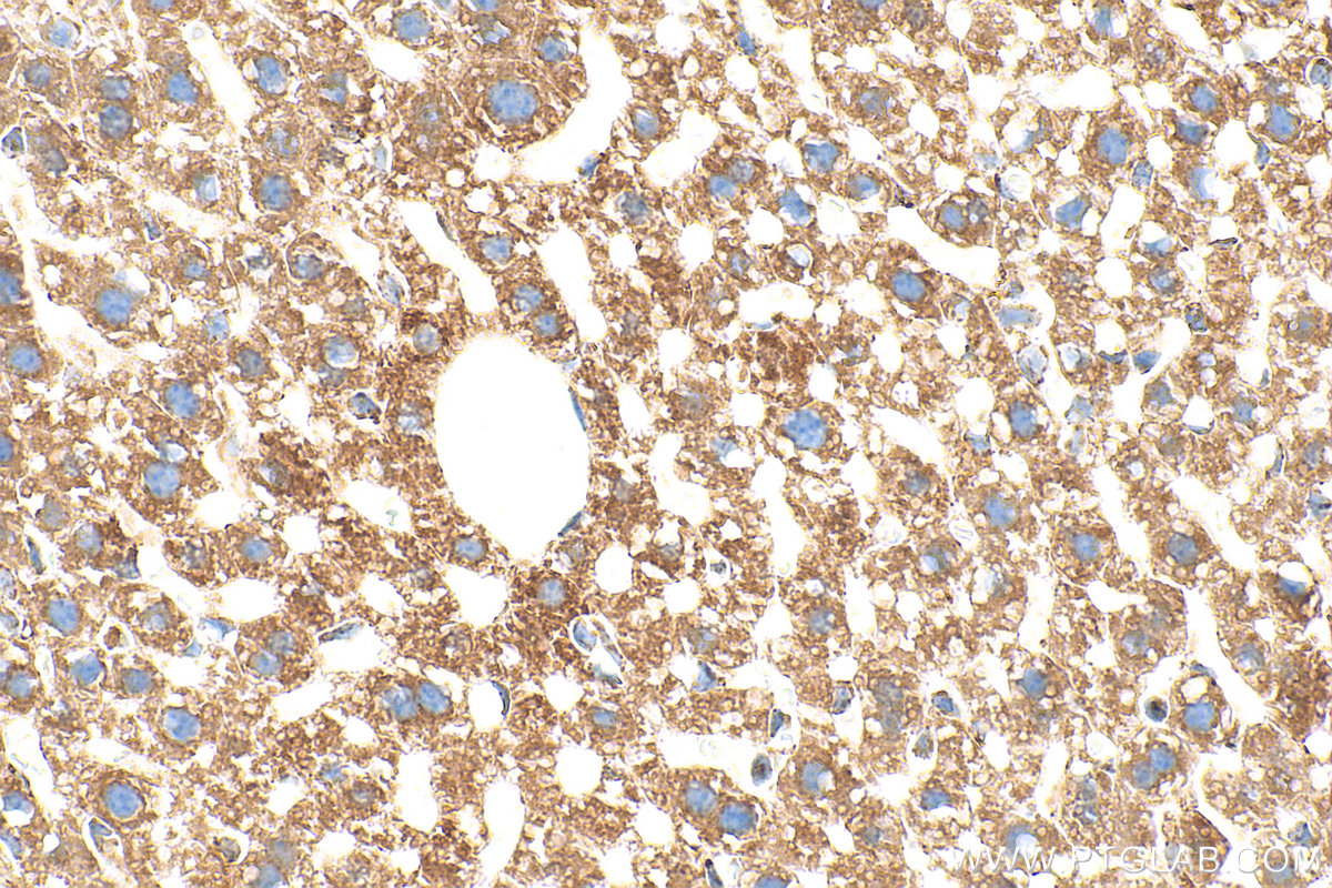 IHC staining of mouse liver using RMX00068 IHC staining of mouse liver using RMX00068