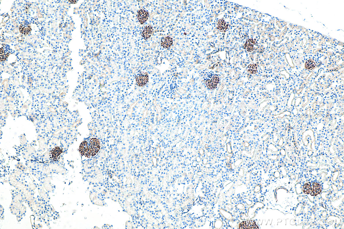 IHC staining of mouse kidney using 80721-1-RR