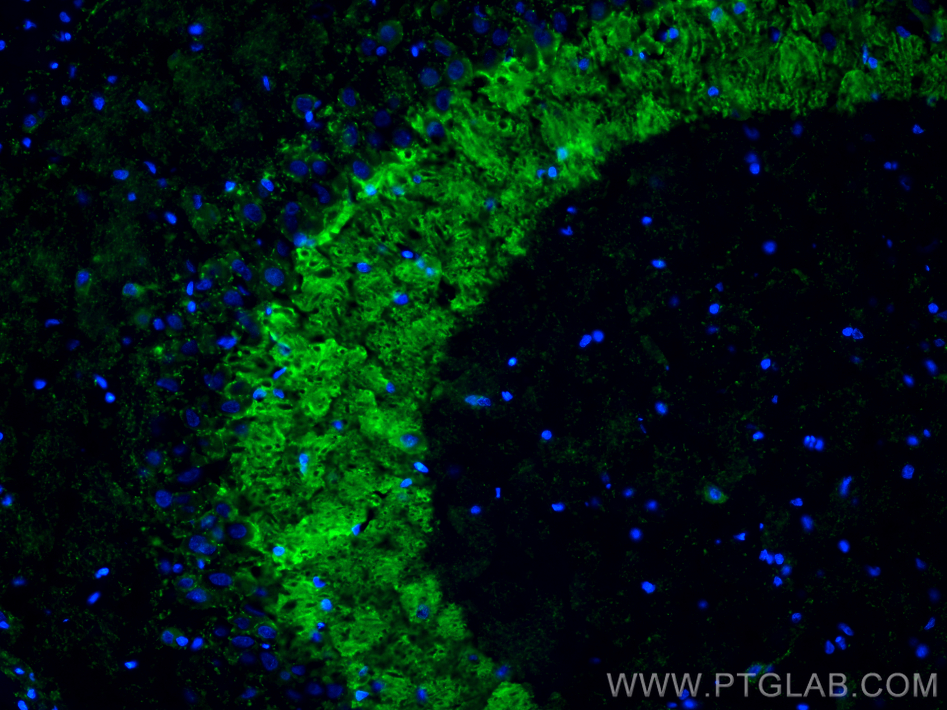 Immunofluorescent analysis of (4% PFA) fixed frozen OCT-embedded rat brain tissue using Synaptoporin antibody (14143-1-AP) at dilution of 1:200 and CoraLite®488-Conjugated Goat Anti-Rabbit IgG(H+L) (<a class='green' href='/productredirect?CatalogNo=SA00013-2' target='_blank'>SA00013-2</a>). IF Staining of rat brain using 14143-1-AP
