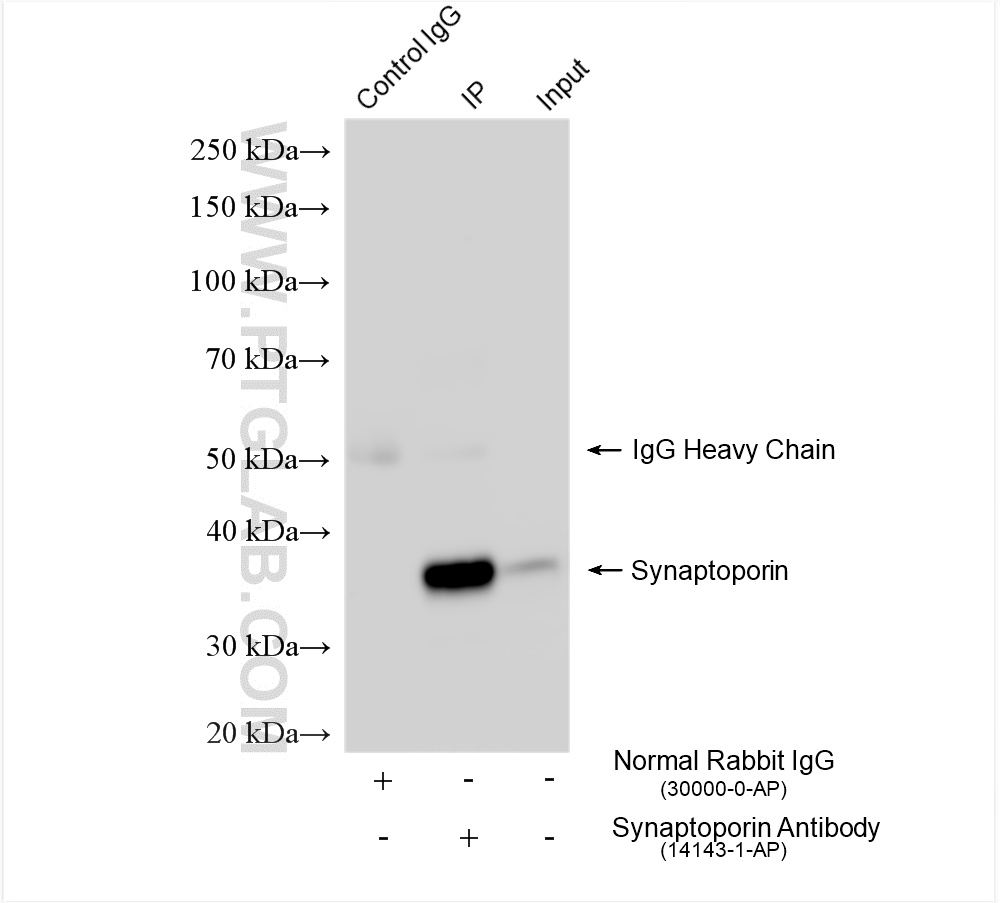 IP experiment of mouse brain using 14143-1-AP