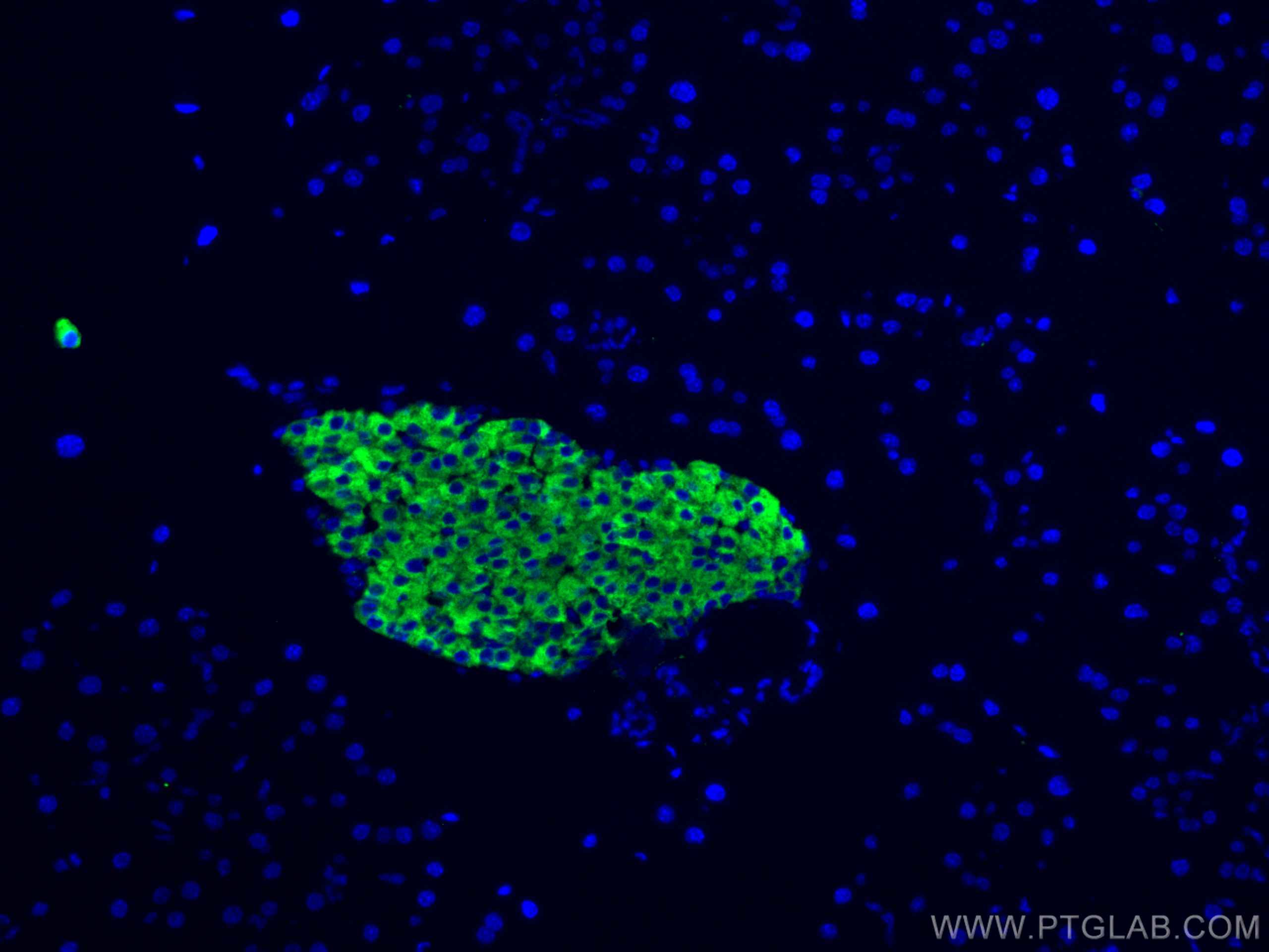 IF Staining of mouse pancreas using 17785-1-AP