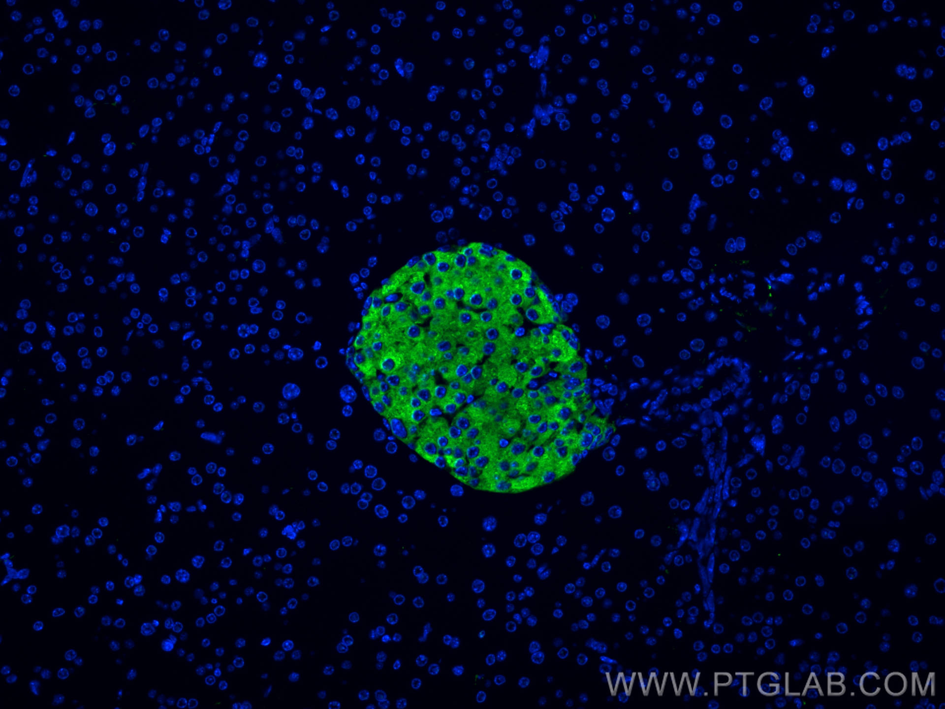 IF Staining of mouse pancreas using 17785-1-AP