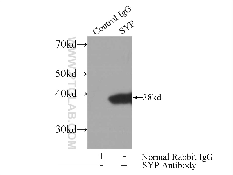 IP experiment of mouse brain using 17785-1-AP