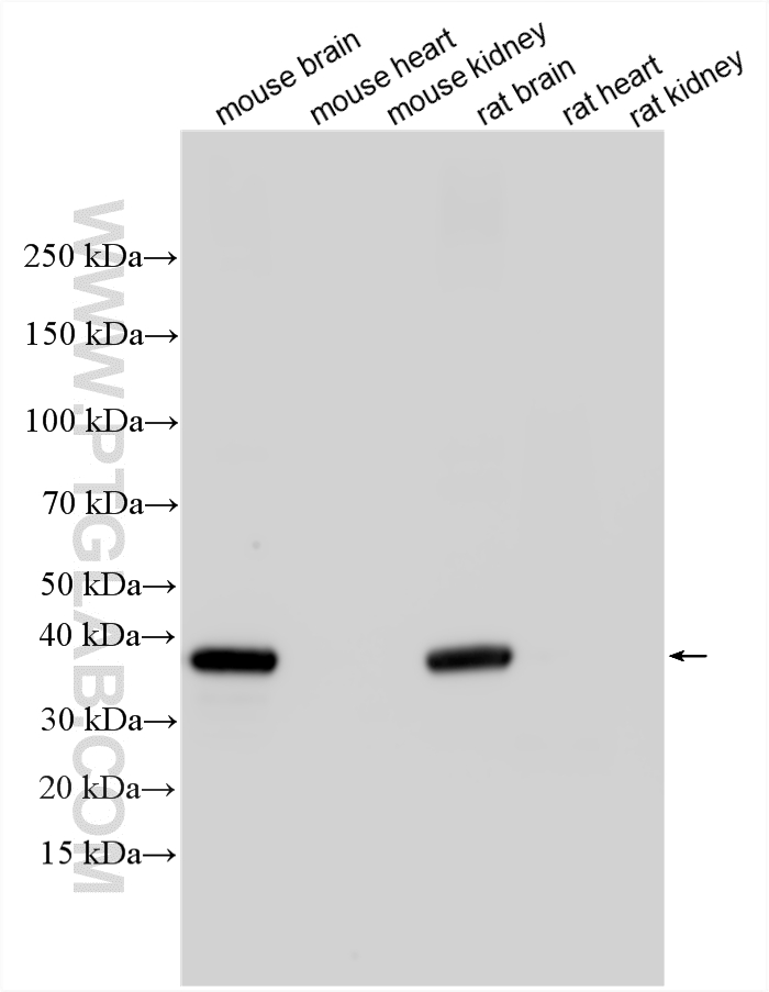 WB analysis using 17785-1-AP