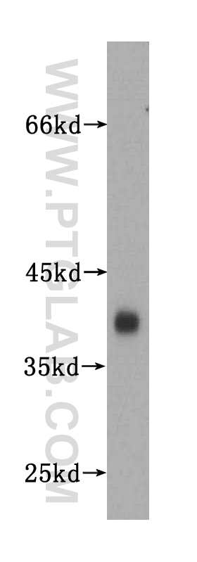 Synaptophysin Polyclonal antibody