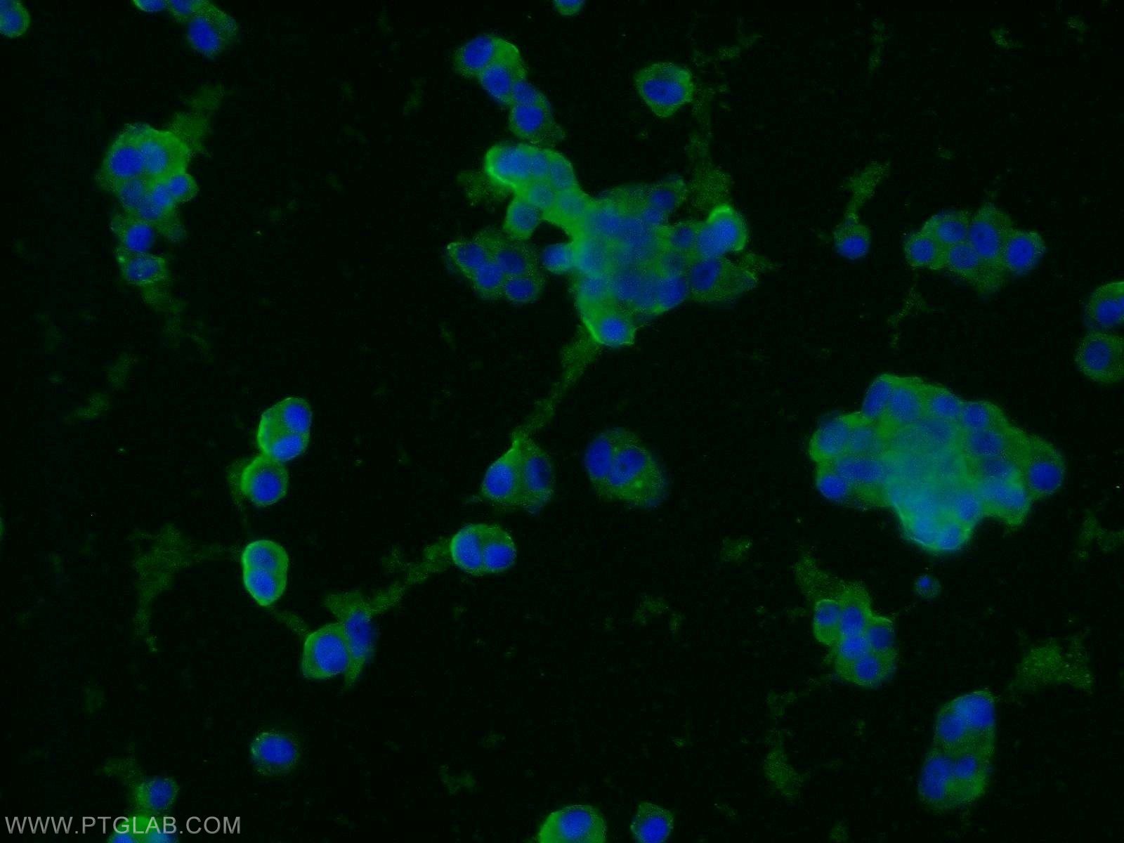 Synaptophysin Monoclonal antibody