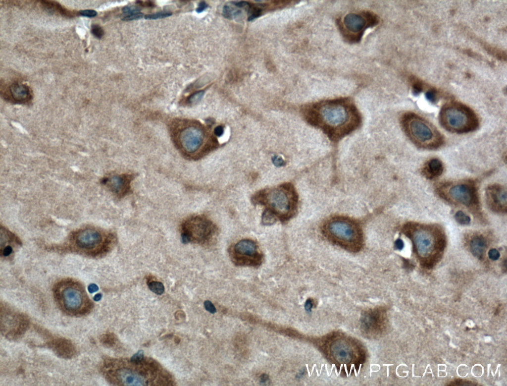 IHC staining of human brain using 60191-1-Ig