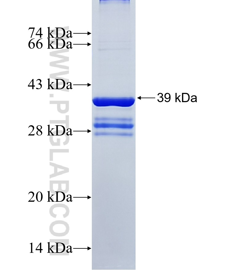 SYPL2 fusion protein Ag18103 SDS-PAGE SYPL2 fusion protein Ag18103 SDS-PAGE